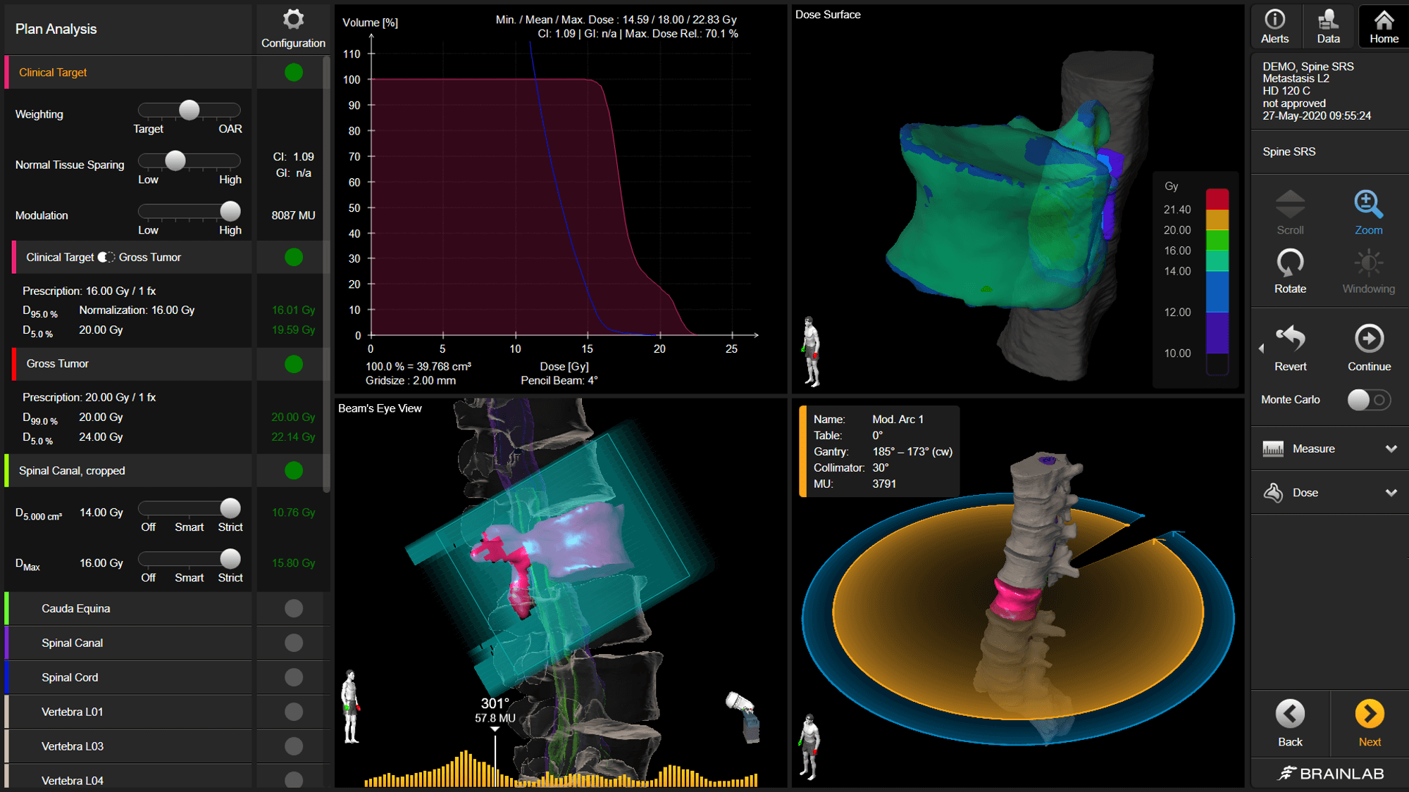 Elements Spine SRS: Spine Metastases Planning | Brainlab